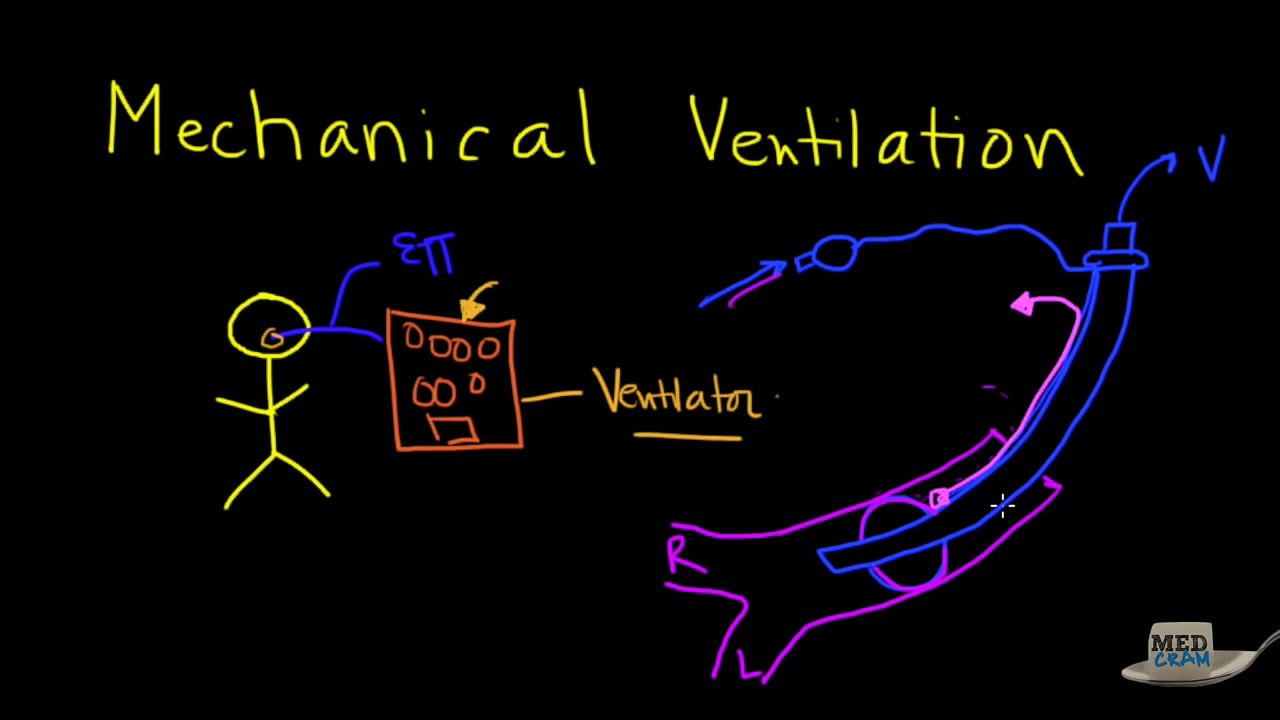 Mechanical Ventilation Explained Clearly
