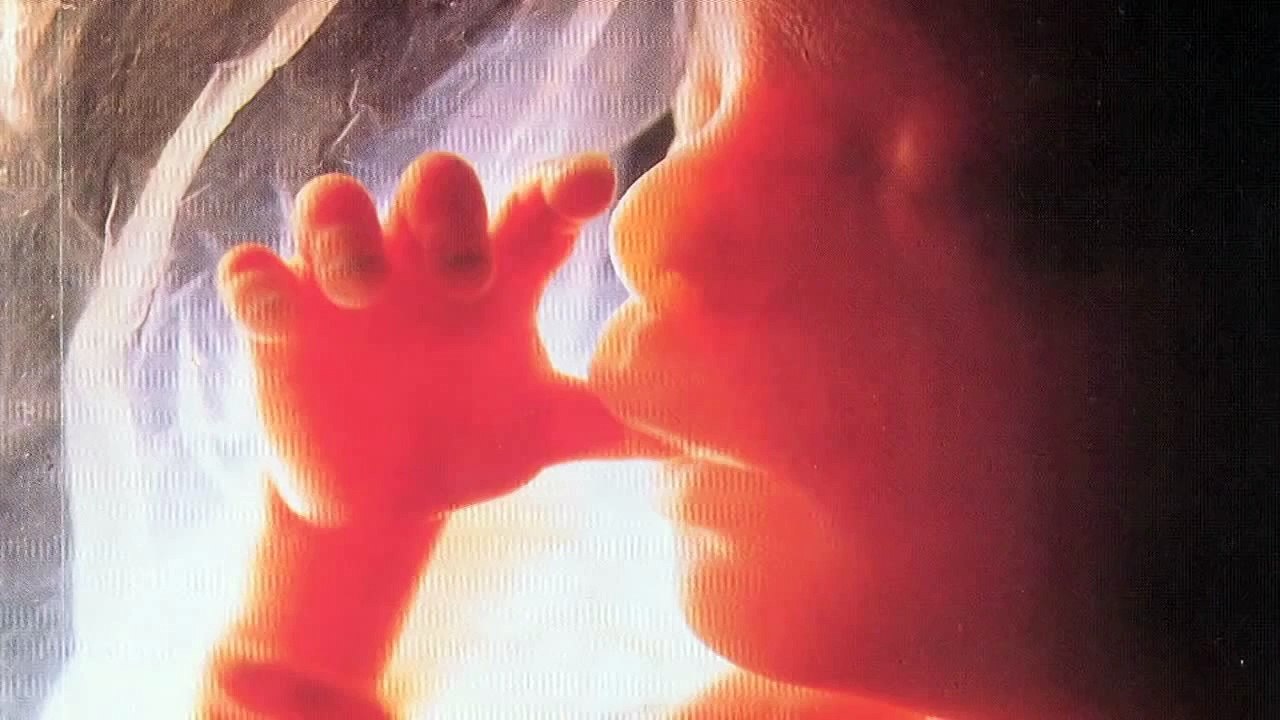 What's Left? Analyzing Remaining Issues