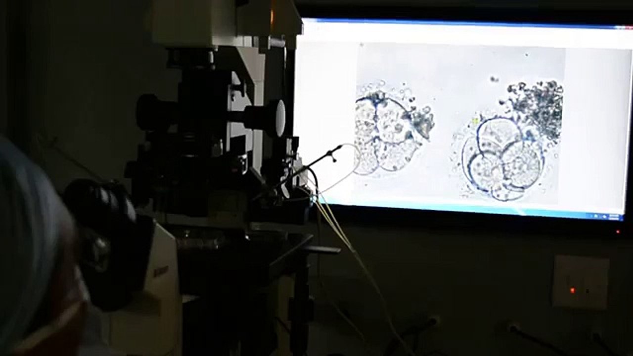 See How Laser is Used to Perform IVF Hatching