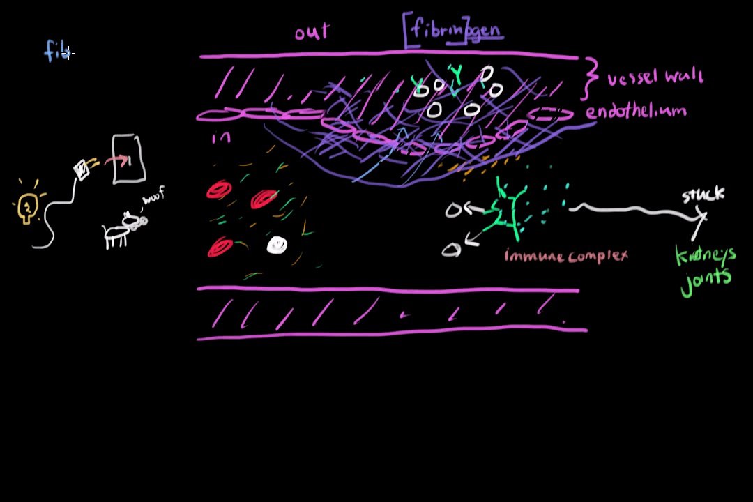 Understanding Vasculitis: Blood Vessel Inflammation