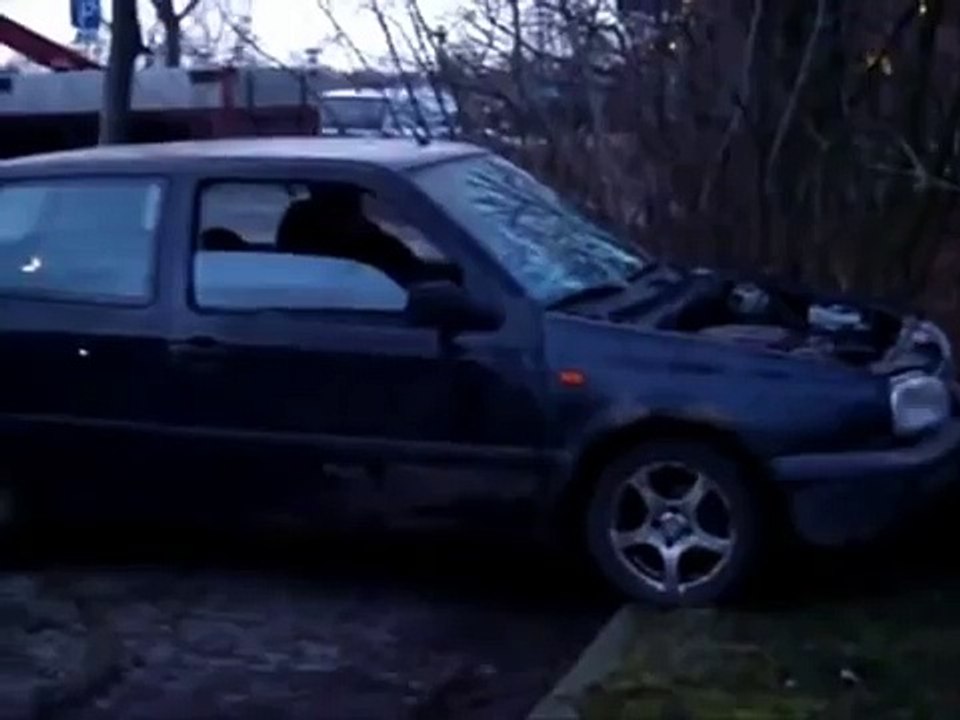 {Finpecia - Making A Substitute For Possess Hair Transplant Surgery|Fixing Wii Hair Transplant|Introducte The Effective Ways To Prevent Hair Loss|Hair Transplant: A Permanent Treatment For Baldness|How Cease Or Treat Hair Loss|Growing Trend Of Fue Hair Tr