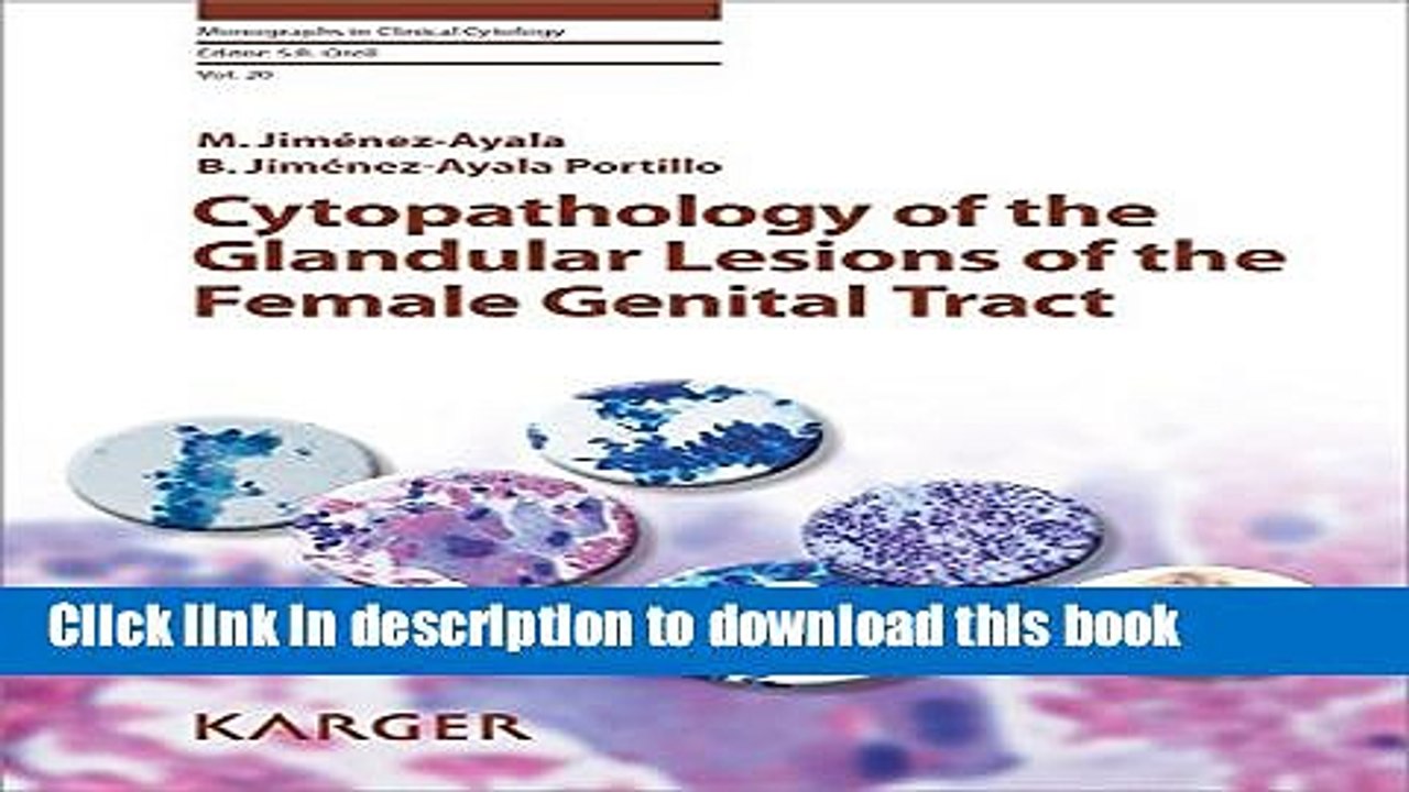 Read Cytopathology of the Glandular Lesions of the Female Genital Tract (Monographs in Clinical