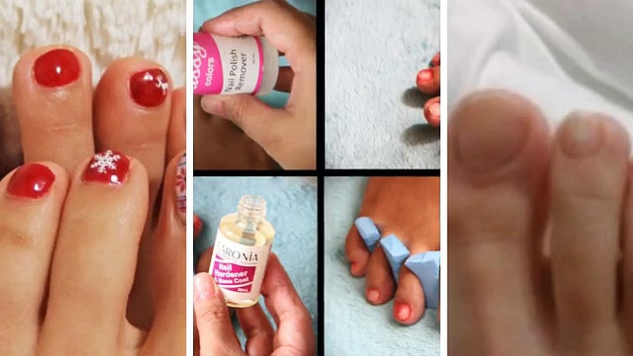 Discover How NailRenew Eliminates Nail Fungi for Healthy, Strong Nails ✨