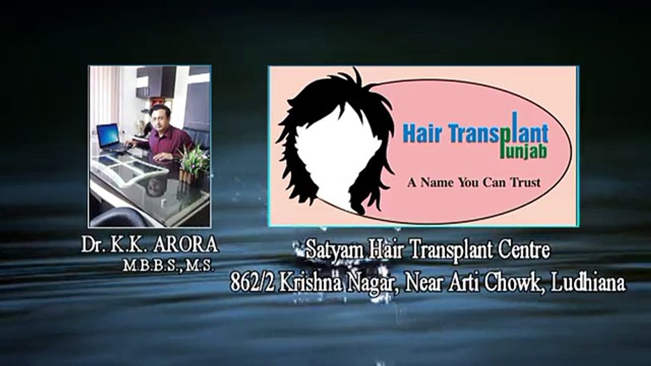 Top Hair Transplant Techniques in India: FUE & FUSS Explained ✨