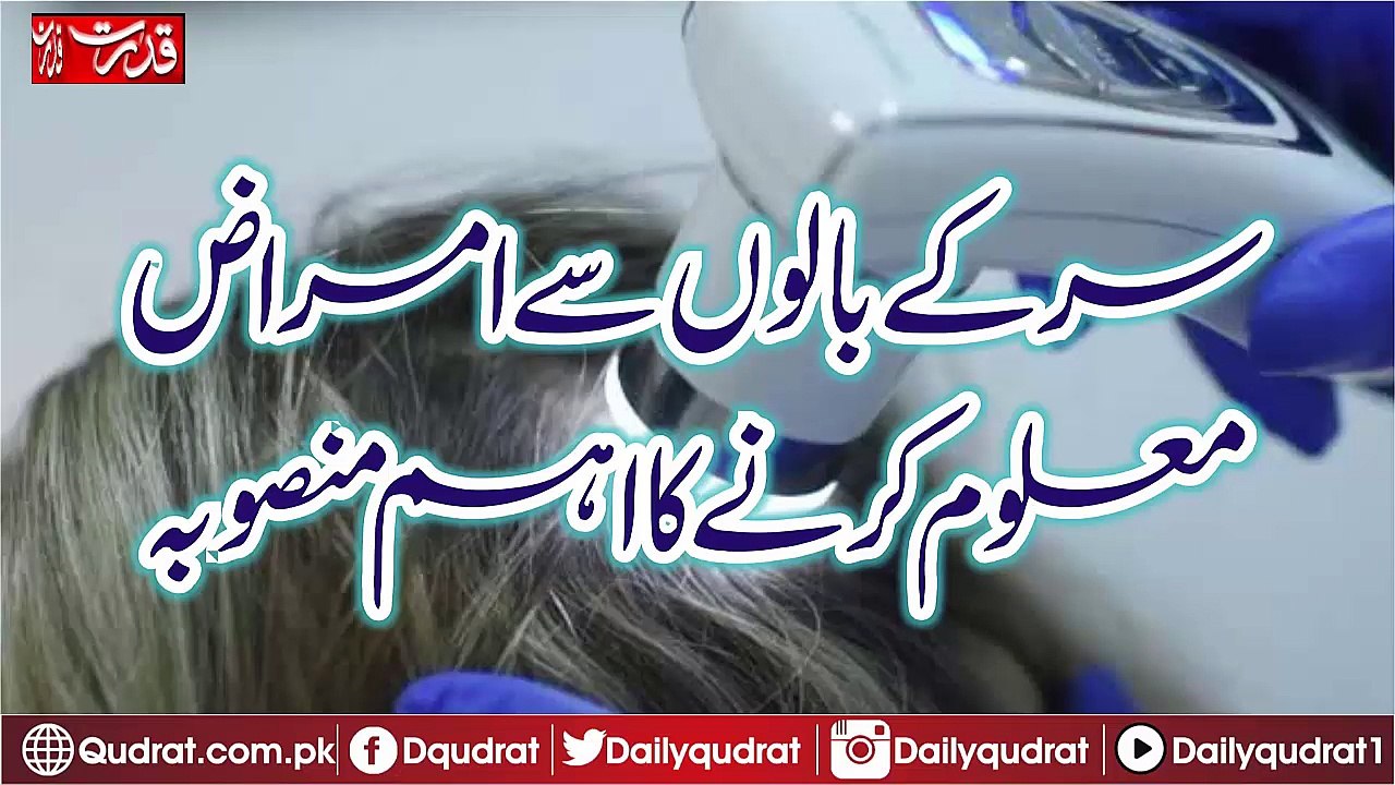 Hair Problem Finding New Machine Introduce