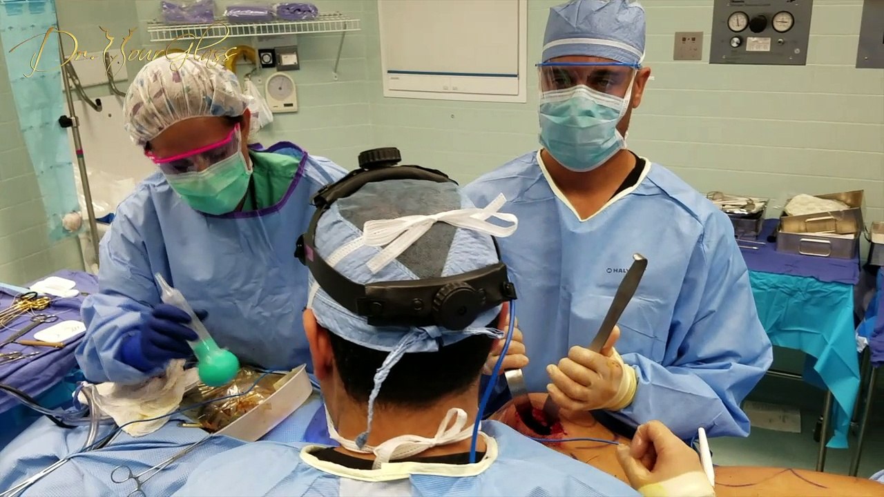 Can I use implants to correct asymmetric buttocks?