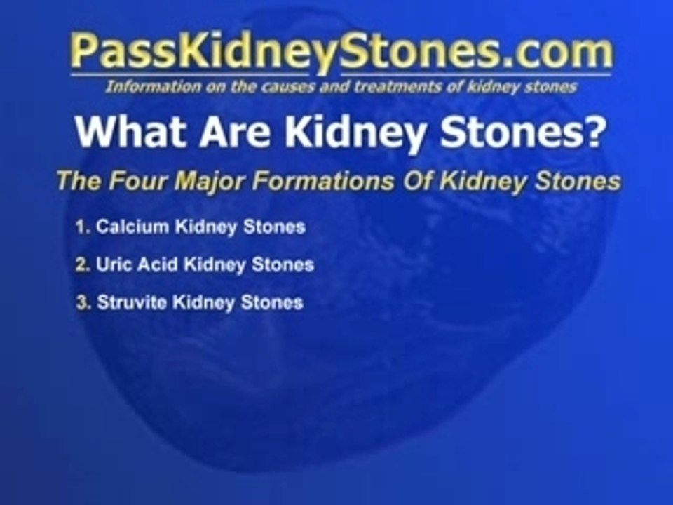 Types of Kidney Stones