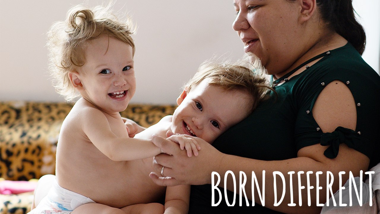 The Twin Sisters Sharing a Body | BORN DIFFERENT