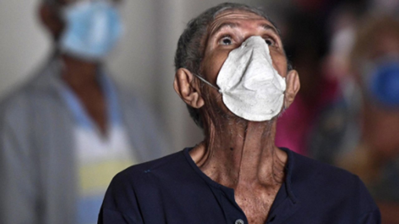 Post Corona Recovery में LONG COVID का खतरा, Symptoms कब तक दिखेंगे | Boldsky