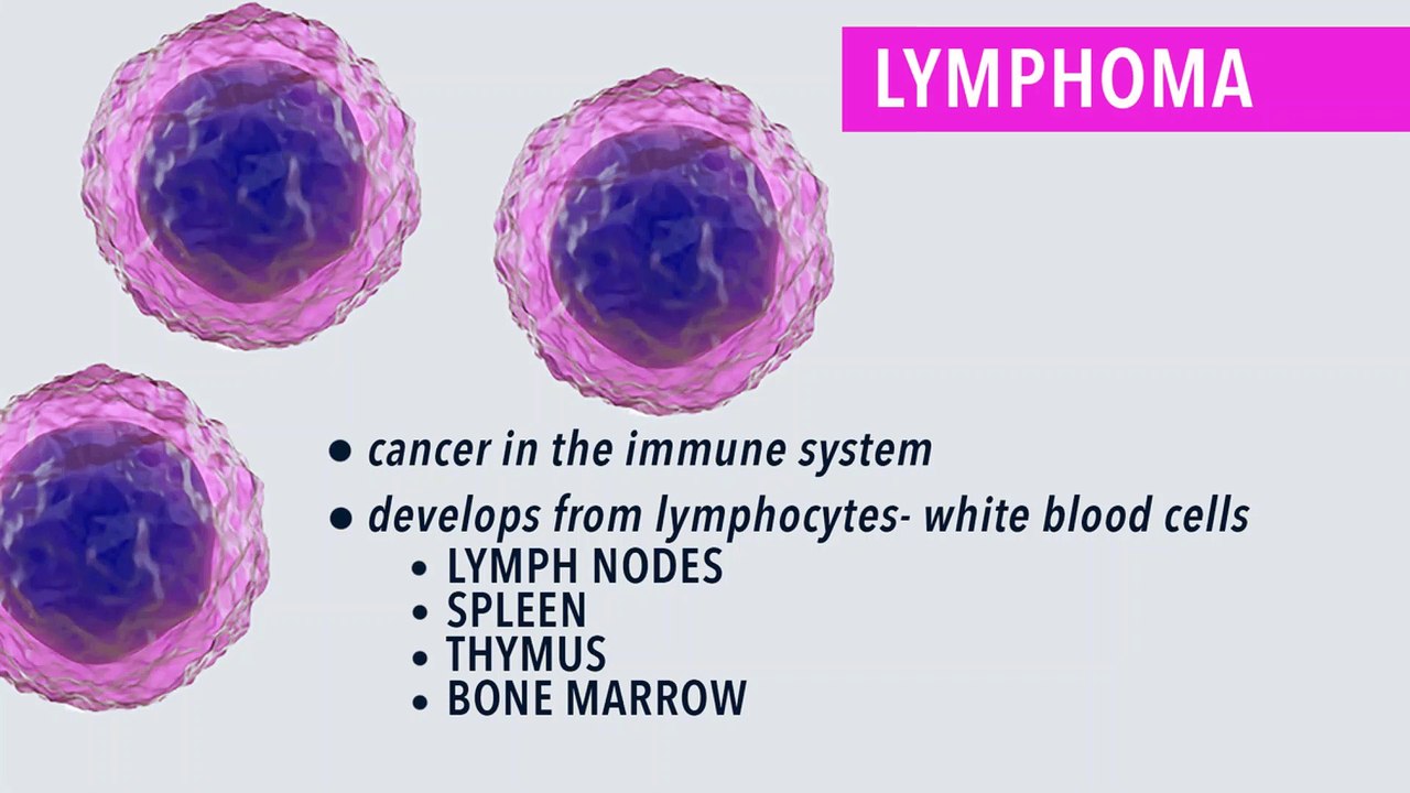 What Is Non-Hodgkin Lymphoma