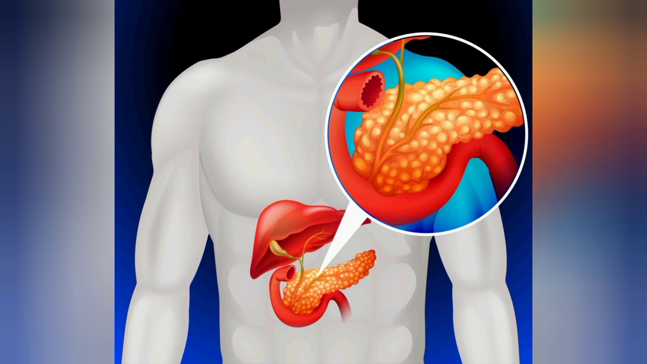Understanding Type 1 Diabetes