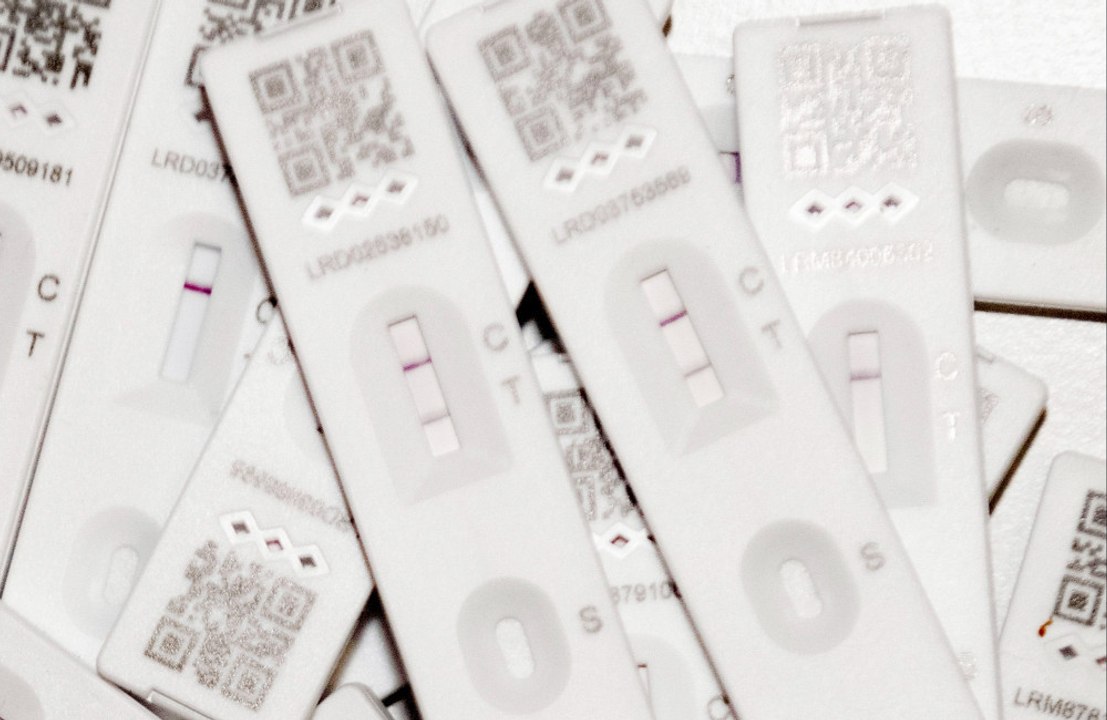 Catching COVID-19 could cause brain changes