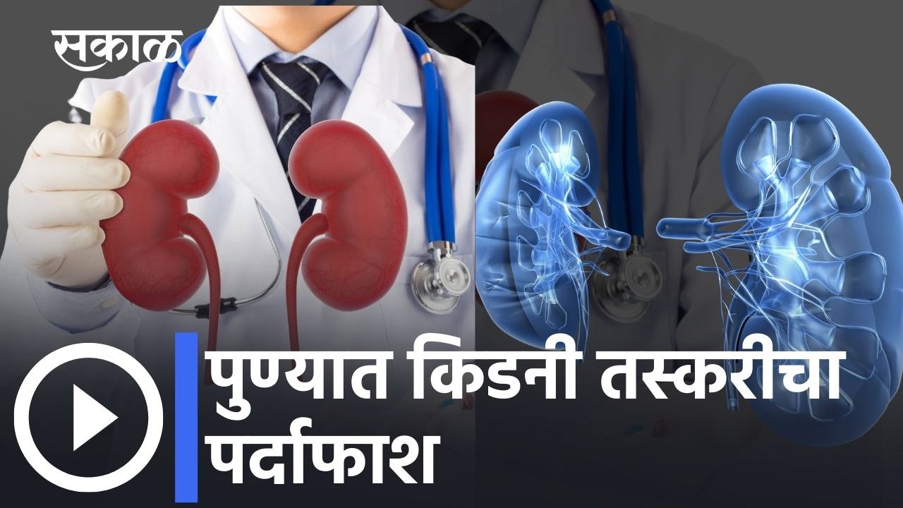 पुण्यात किडनी तस्करीचा पर्दाफाश; महिलेला १५ लाख रुपयांसाठी फसवणूक