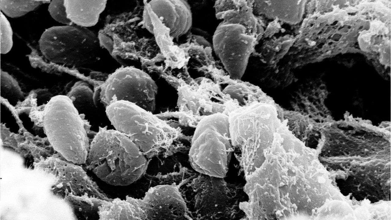 Origine géographique de la peste noire