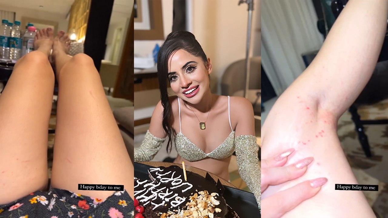 Urfi Javed को अपने 25th Birthday पर लगी चोट, Birthday Celebration से पहले Share किया Injury Video!