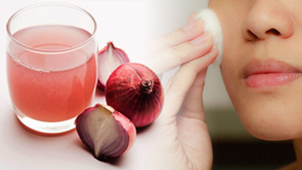 चेहरे पर प्याज का रस लगाने के जबरदस्त फायदे | प्याज का रस लगाने से क्या होता है | Boldsky *Health