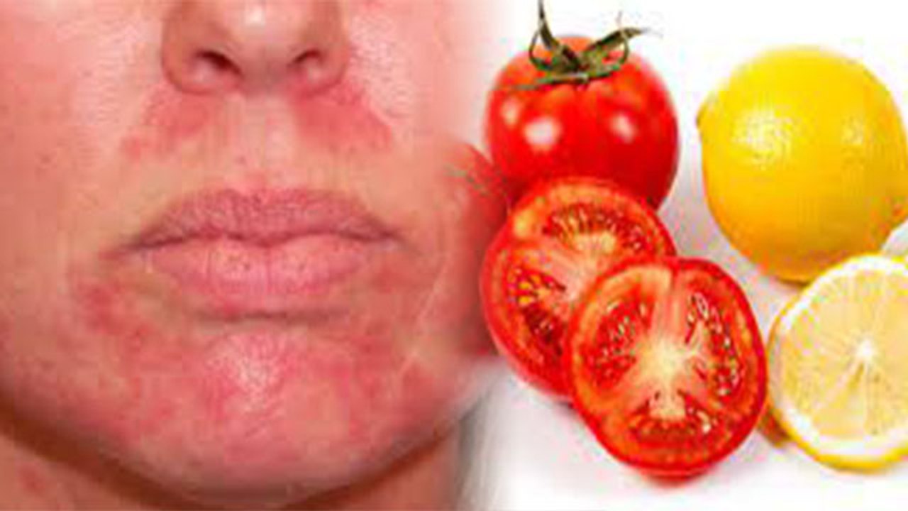 चेहरे पर टमाटर और नींबू लगाना चाहिए या नहीं । चेहरे पर टमाटर और नींबू लगाने के फायदे।Boldsky *Health