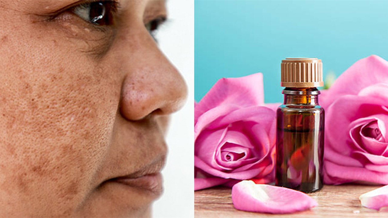 गुलाब का तेल चेहरे पर लगाने से क्या होता है,गुलाब का तेल चेहरे पर लगाने के फायदे | Boldsky *Health