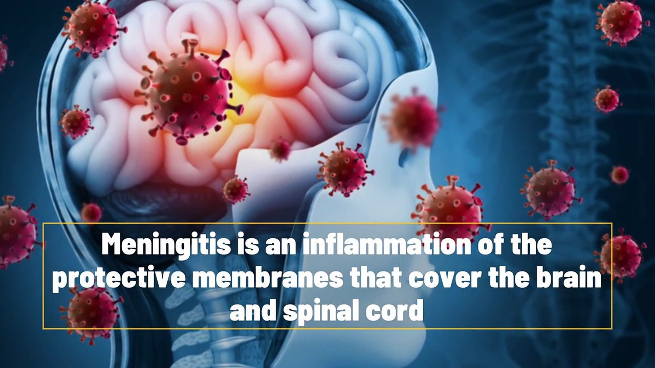 What Is Meningitis?