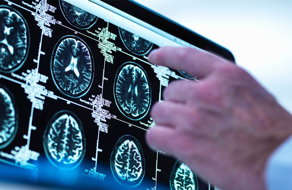 Brain-scanning tech risks workplace surveillance