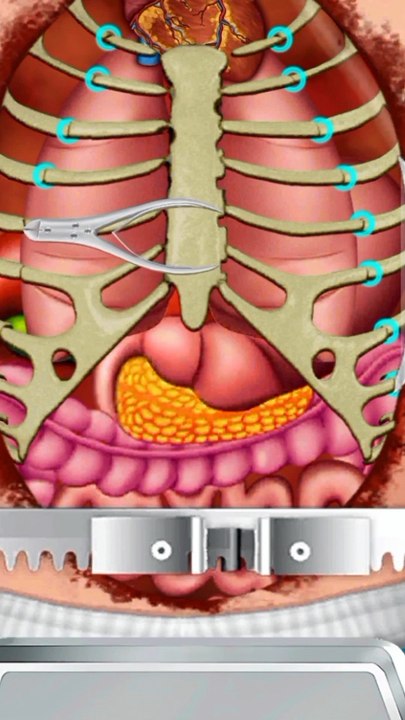 ASMR Treatment of infections caused by wearing facial piercings - 얼굴 피어싱 착용으로 인한 감염 치료 asmr, asmr, asmr animation, 메이크업, 애니메이션, 스톱모션, treament animation, piercing, Treatment, facial piercings, remove plantar warts animation, treat foot naturally
