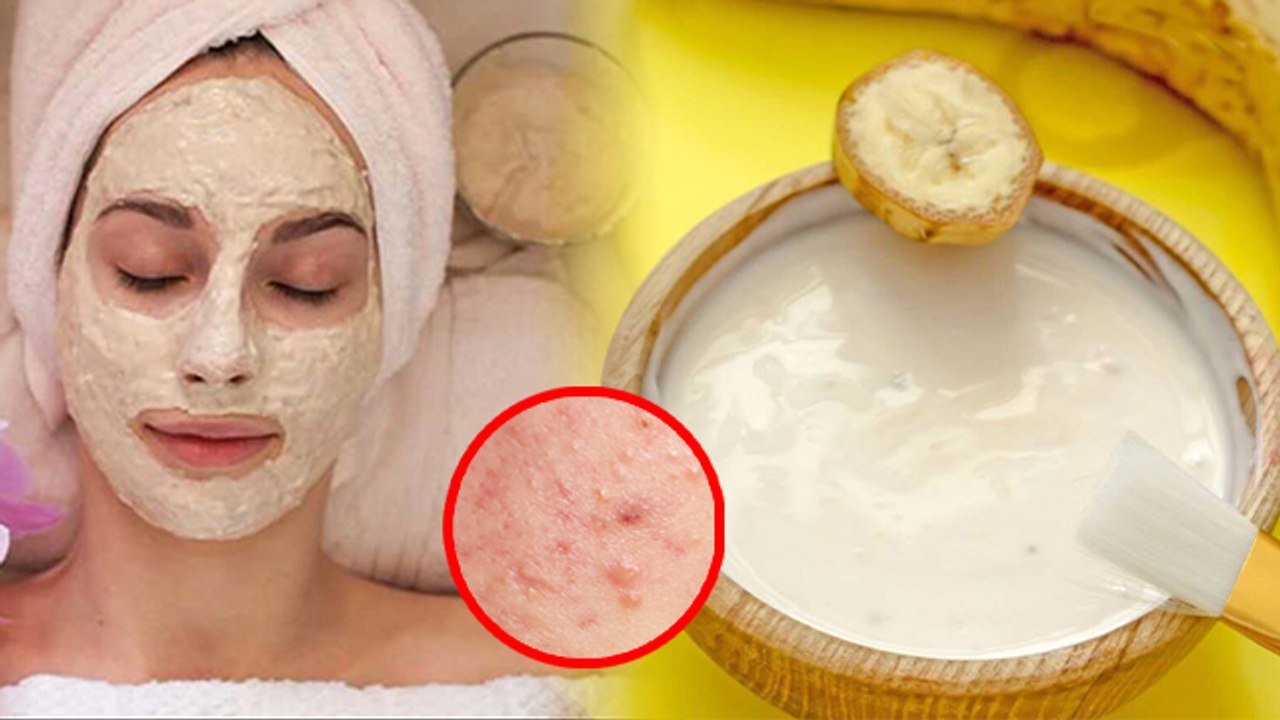 Face पर केला और दही लगाने से क्या होता है | Chehre Per Kela Dahi Face Pack Lagane Ke Fayde | Boldsky