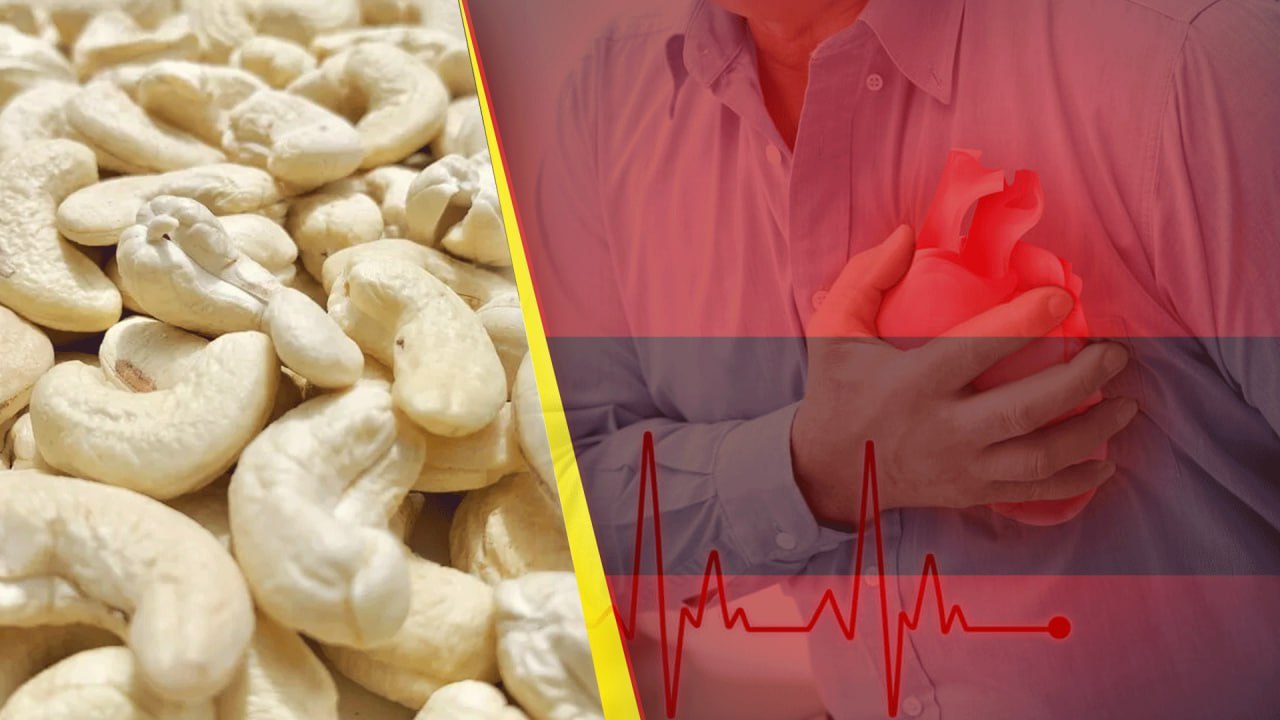 Cashew Nuts జీడిపప్పు అందరూ తినటం మంచిది కాదు .. ఎందుకో తెలుసా...? | Telugu OneIndia