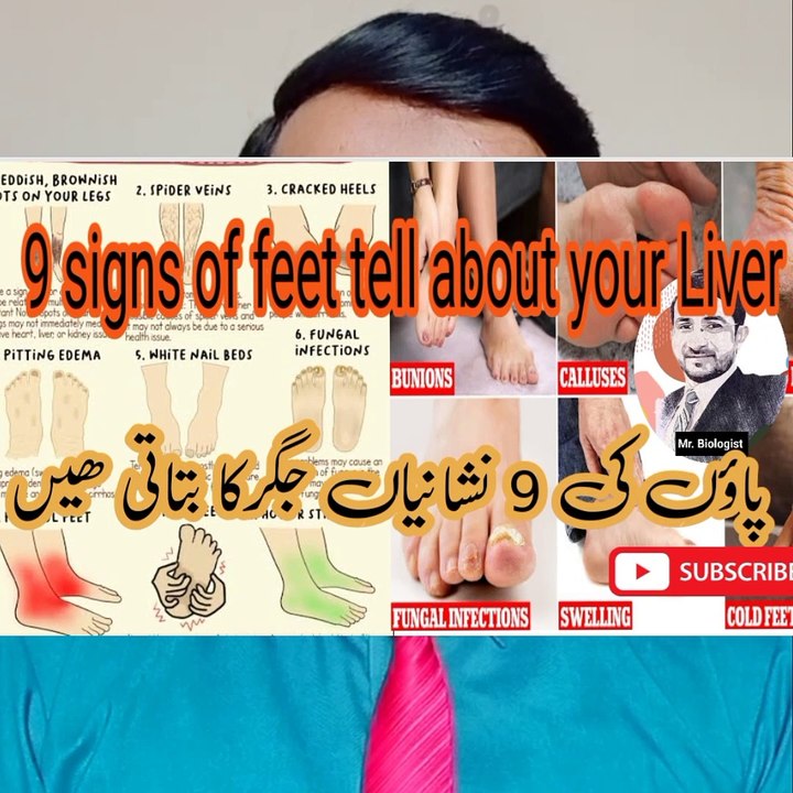 9 signs of feet tell about your Liver