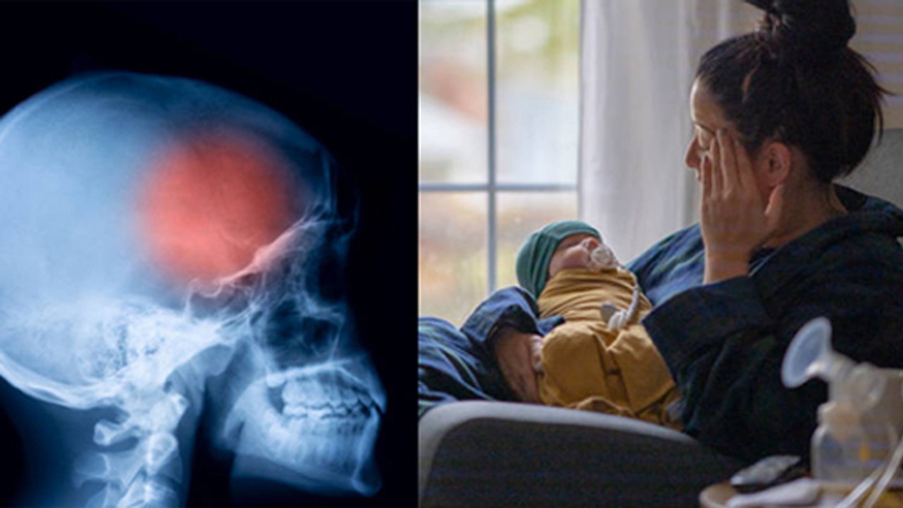 Postpartum Depression क्या है, Symptoms Reason और Treatment | Boldsky