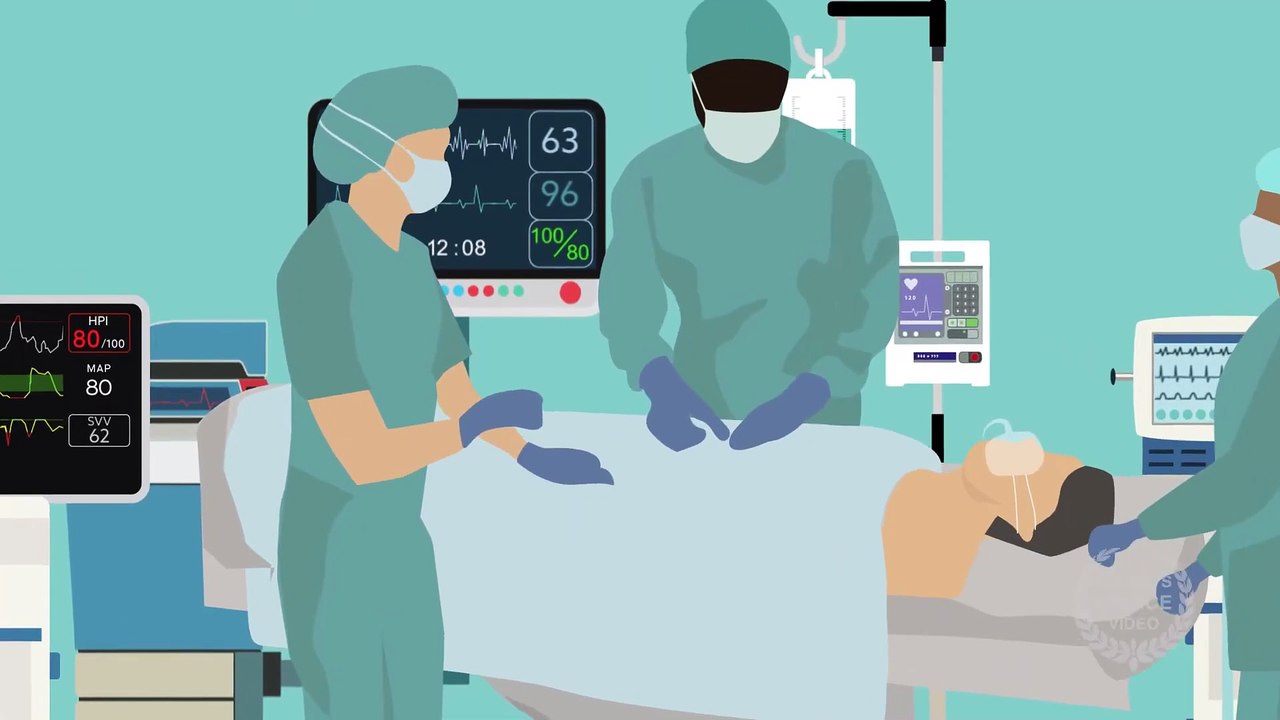 Can Hypotension Prediction Algorithms Effectively Prevent Low Blood Pressure During Surgery? 🤔