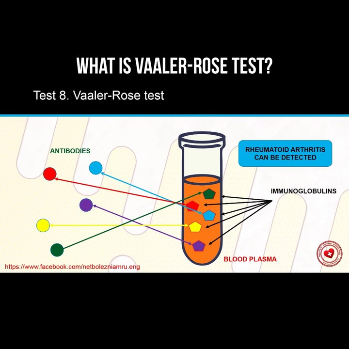 What is Vaaler-Rose test?