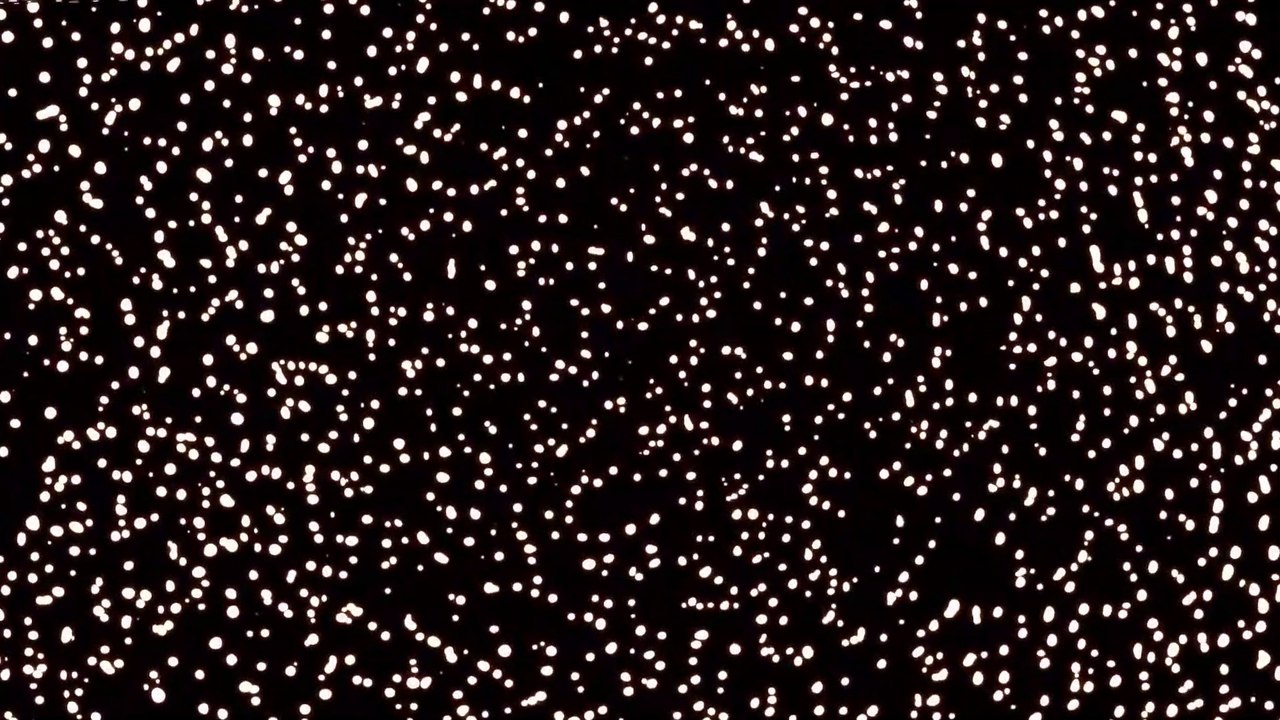 Assey - Don't Sleep (Music Video)