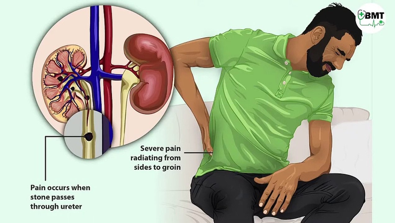 Basic concept of Dialysis Machine _ Fresenius 4008S _ Dialyzer & Dialysate Function
