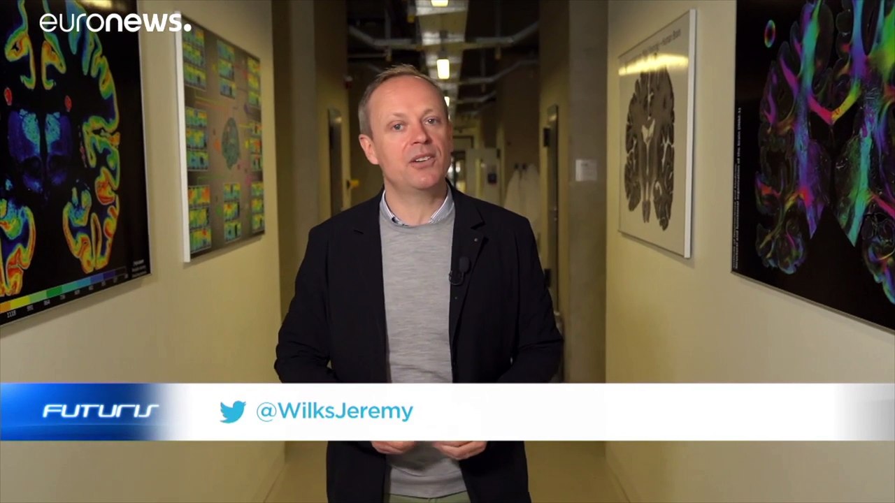 Microdocumental: ¿Cómo funciona el cerebro?