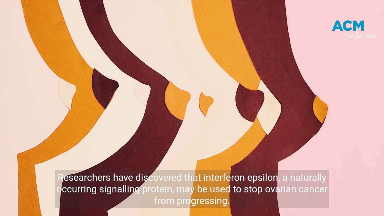 Ovarian cancer treatment breakthrough | The Senior | August 18, 2023