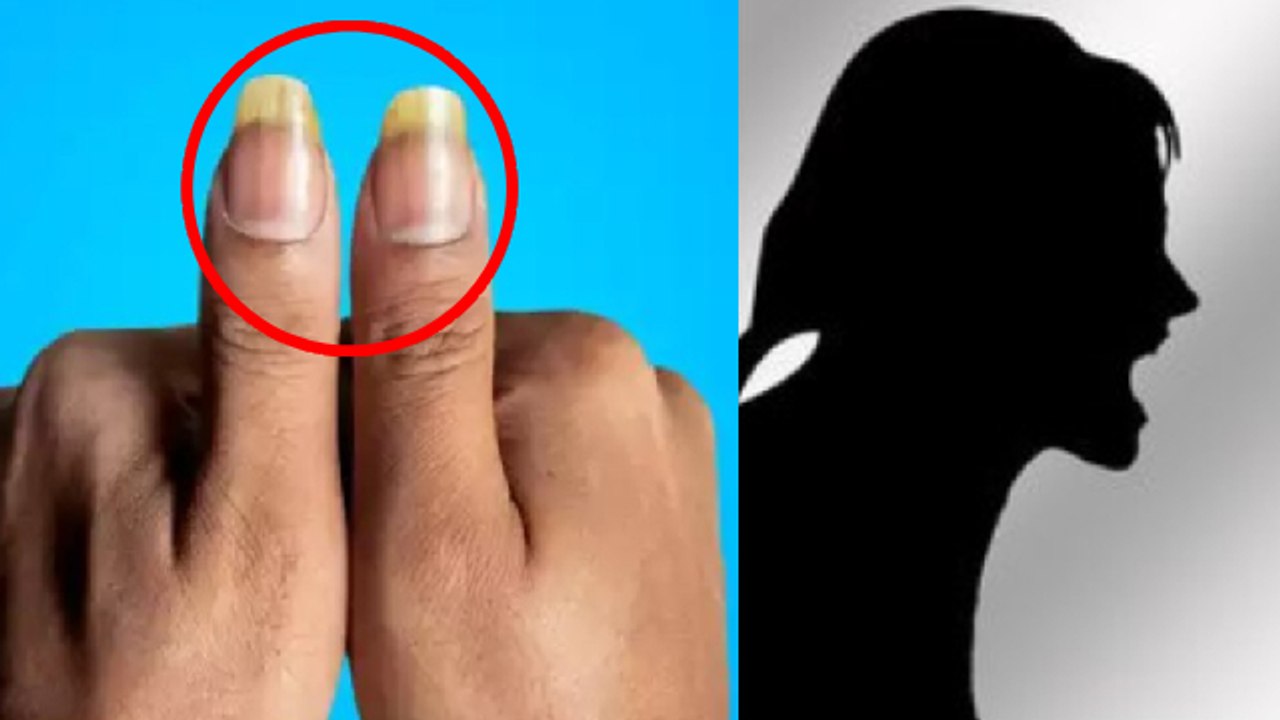 Nakhun Par Aadha Chand Ka Matlab | Nakhun Par Aadha Chand Kyon Hota Hai | Boldsky