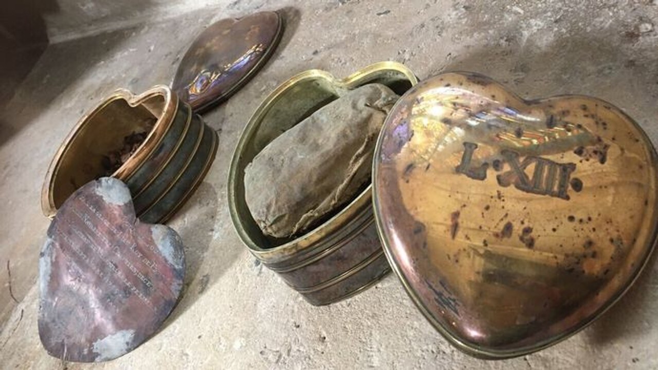 L'histoire au scalpel - L'étrange histoire des coeurs des rois