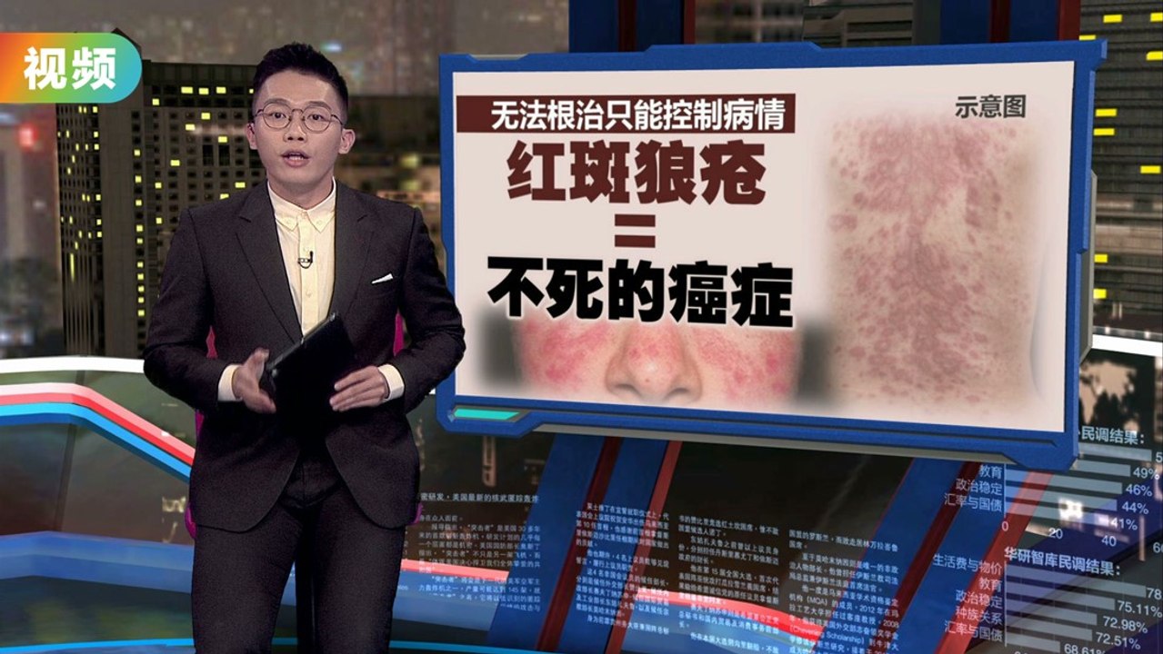 一代女神周海媚香消玉殒 “红斑狼疮”冲上热搜