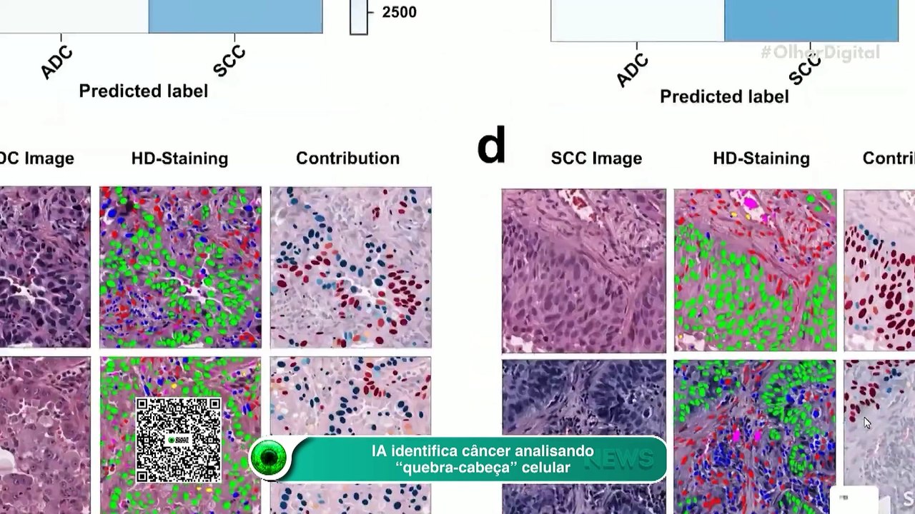 IA identifica câncer analisando “quebra-cabeça” celular