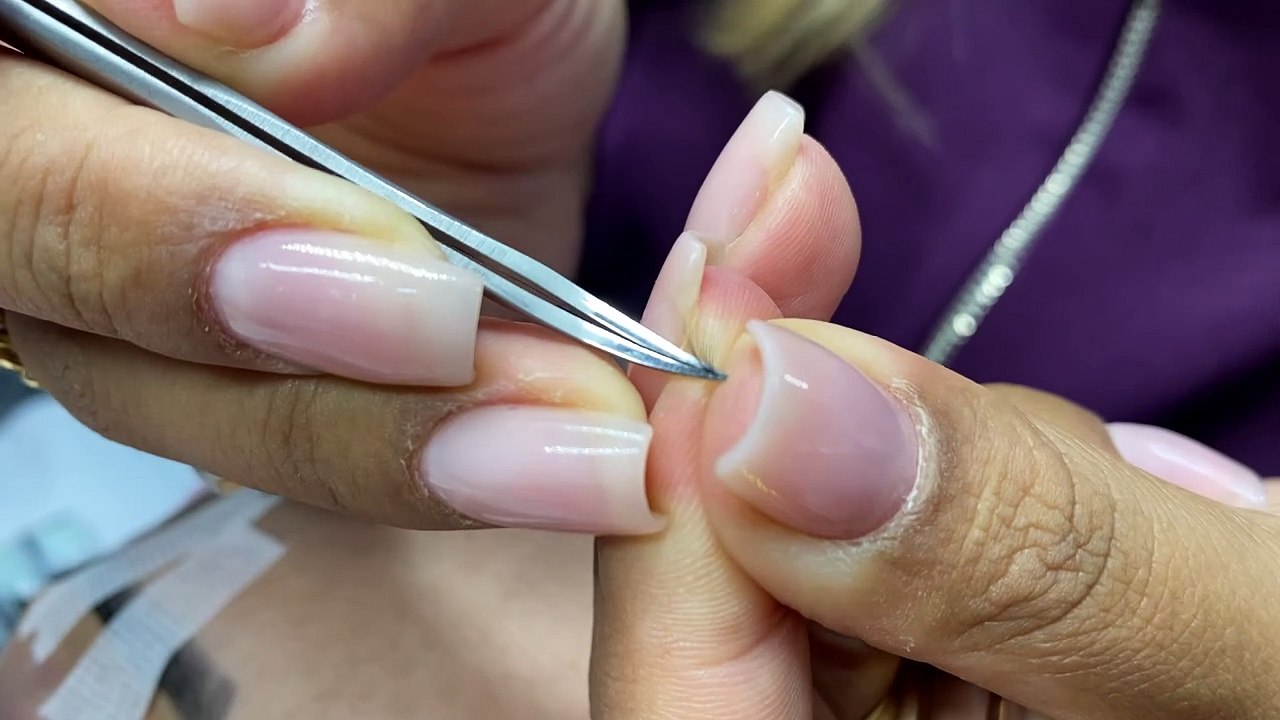 Procedimento na Prática