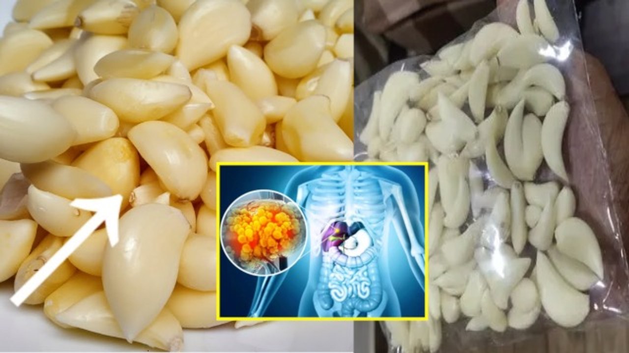 छिले हुए लहसुन से इस गंभीर बीमारी का खतरा | Chila Hua Lahsun Ko Store Kaise Karen | Boldsky