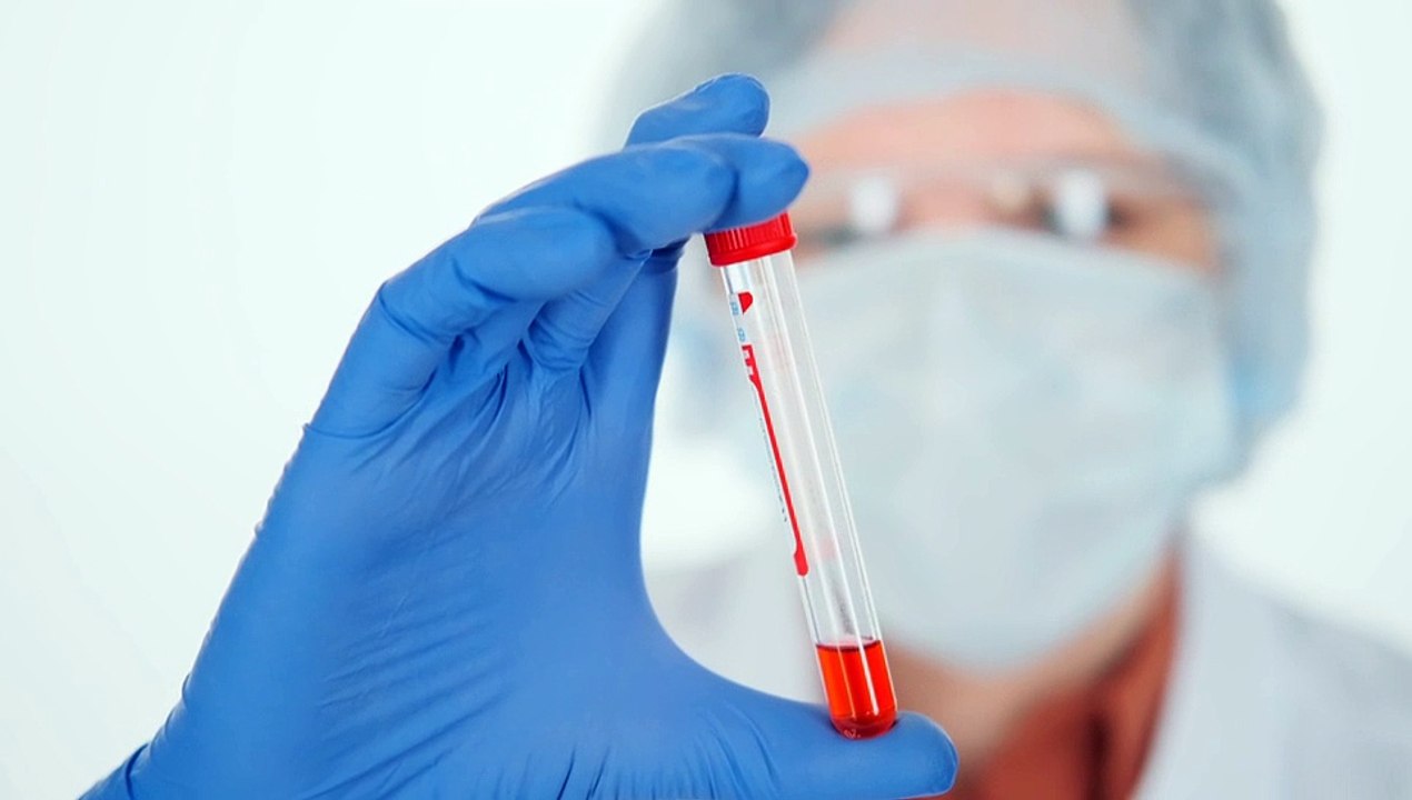 Análisis de coronavirus