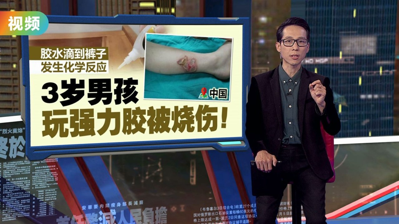 胶水滴到裤子发生化学反应   小男孩玩强力胶被烧伤