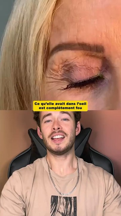 Ce qu’elle avait dans l’oeil est fou