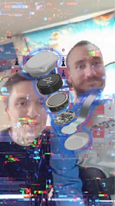  Le premier patient de Neuralink joue aux échecs par la pensée sur un écran