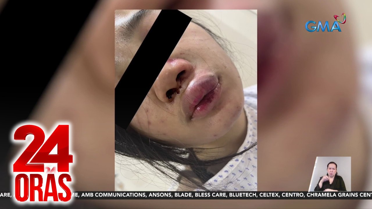 Taekwondo yellow belter na pinag-sparring umano ng coach sa black belter, naospital | 24 Oras