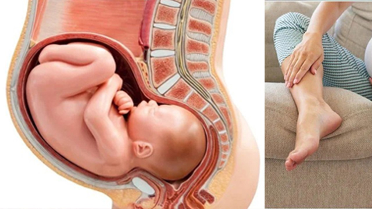 Pregnancy Me Pair Ki Edi Me Dard Kyu Hota Hai|Pregnancy Me Leg Pain Kyu Hota Hai|Boldsky