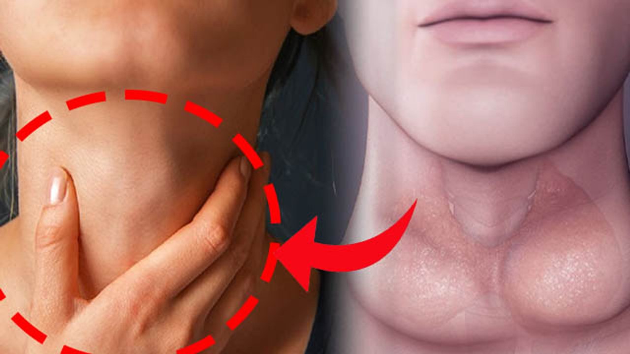 Hyperthyroidism And Hypothyroidism Difference | Hyperthyroidism Or Hypothyroidism Symptoms | Boldsky