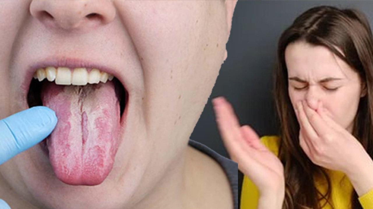 नाक से बदबू आना कौन सी बीमारी है | Naak Se Badbu Kyu Aati Hai | Boldsky