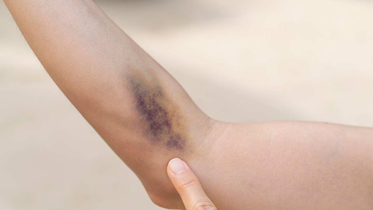 bd-sangrados-inexplicables-que-podria-estar-pasando-080424